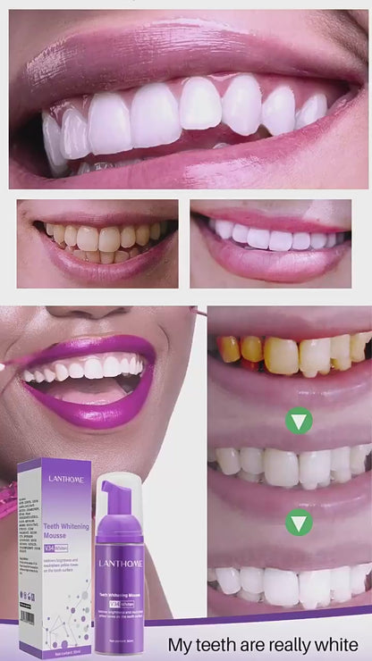 Mousse blanchissante pour les dents Nettoyage en profondeur